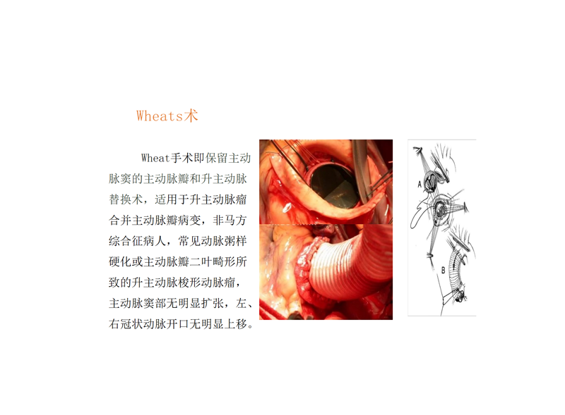 新技术项目（1）富智已审_03.png