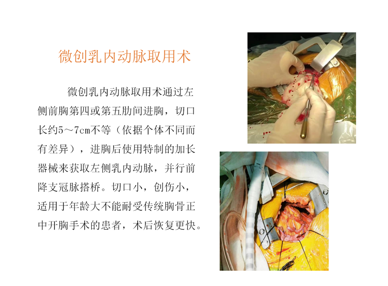 新技术项目  (2)王巍已审_03.png
