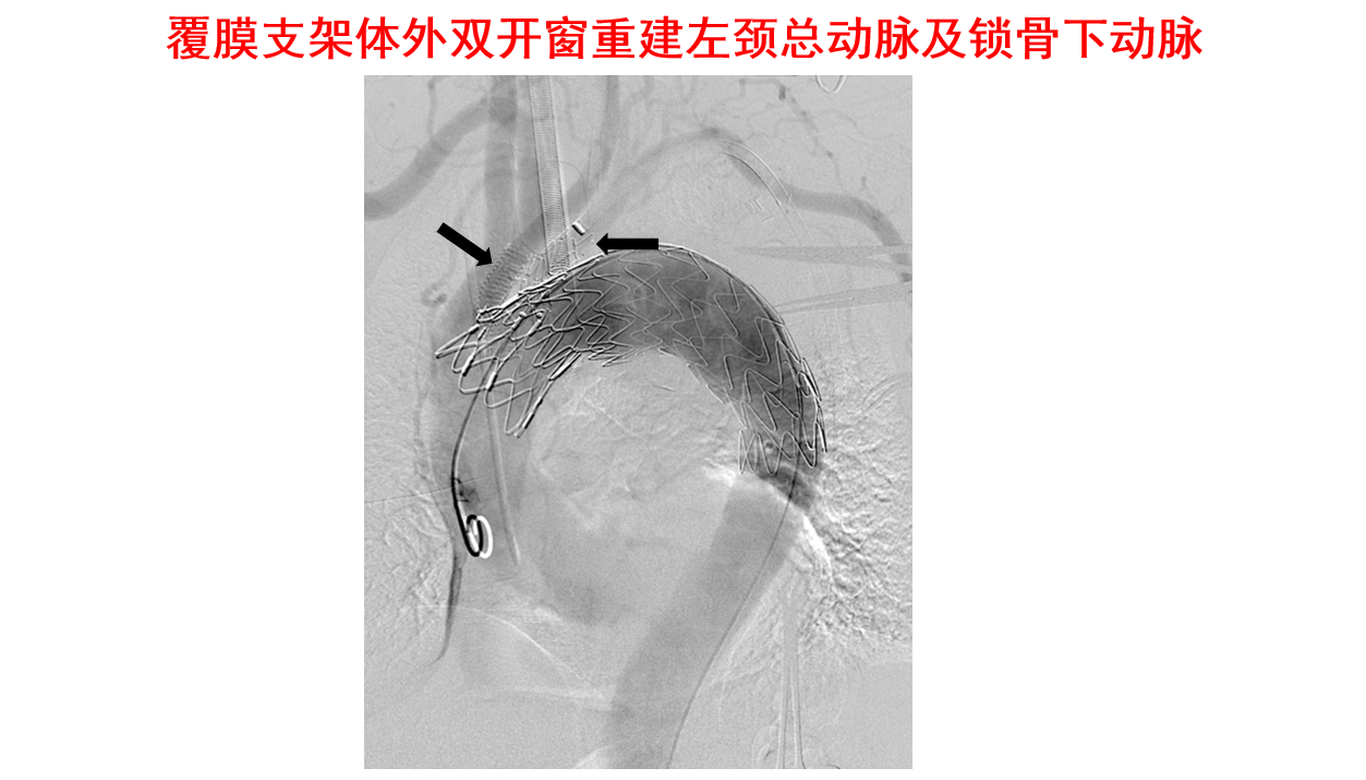 微信图片_202206201450223.png